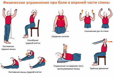 Физические упражнения при болях в верхней части спины
